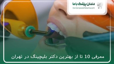بهترین دکتر بلیچینگ در تهران