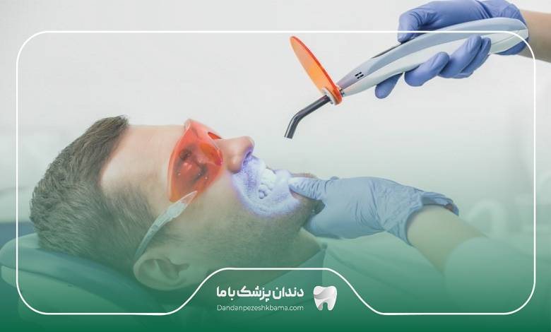 بهترین دکتر بلیچینگ در تهران