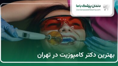 بهترین دکتر کامپوزیت در تهران