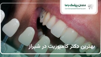 بهترین دکتر کامپوزیت در شیراز