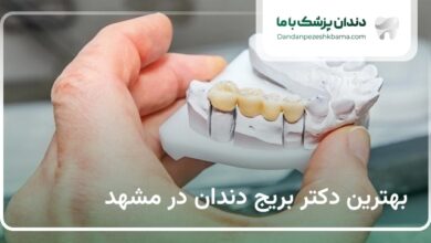 بهترین دکتر بریج دندان در مشهد