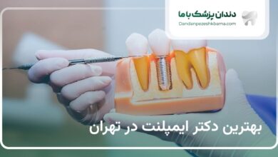بهترین دکتر ایمپلنت در تهران