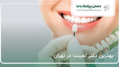 بهترین دکتر لمینت در تهران