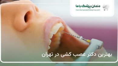 بهترین دکتر عصب کشی در تهران