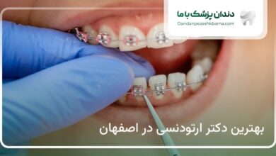 بهترین دکتر ارتودنسی در اصفهان