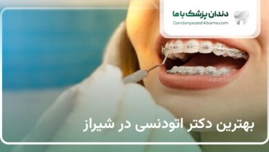 بهترین دکتر اتودنسی در شیراز
