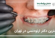 بهترین دکتر ارتودنسی در تهران