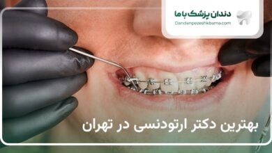 بهترین دکتر ارتودنسی در تهران
