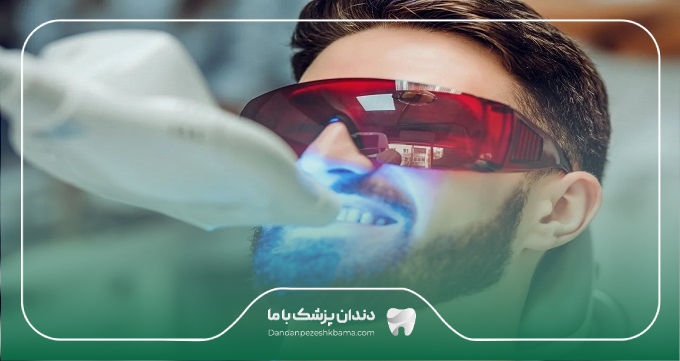 هزینه خدمات بهترین دکتر بلیچینگ در مشهد