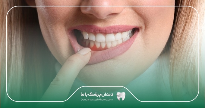 خدمات تخصصی بهترین دکتر لثه در سعادت آباد