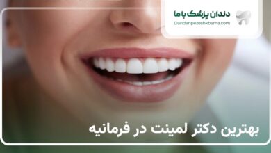 بهترین دکتر لمینت در فرمانیه