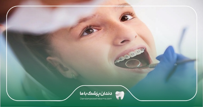 راهنمای دریافت نوبت از بهترین دکتر ارتودنسی کودکان در تهران