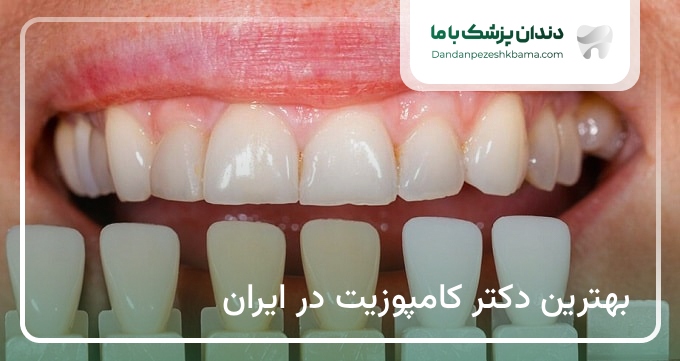 بهترین دکتر کامپوزیت در ایران
