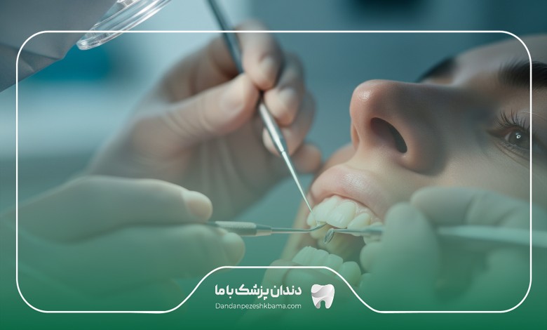 هزینه کامپوزیت دندان در سعادت آباد