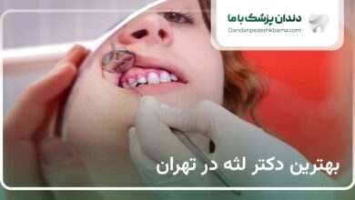 بهترین دکتر لثه در تهران