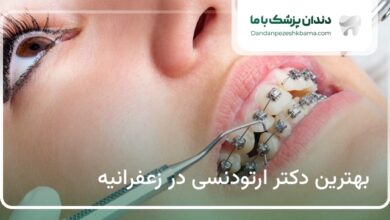 بهترین دکتر ارتودنسی در زعفرانیه