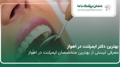 بهترین دکتر ایمپلنت در اهواز