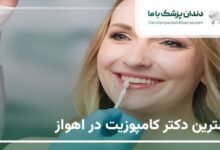 بهترین دکتر کامپوزیت در اهواز