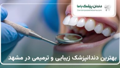 بهترین دندانپزشک زیبایی و ترمیمی در مشهد