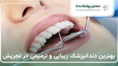 بهترین دندانپزشک زیبایی و ترمیمی در تجریش