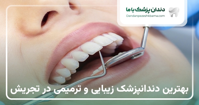 بهترین دندانپزشک زیبایی و ترمیمی در تجریش