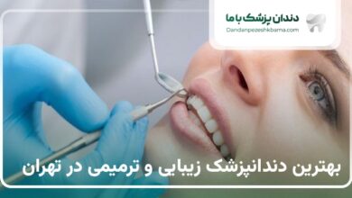 بهترین دندانپزشک زیبایی و ترمیمی در تهران