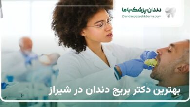بهترین دکتر بریج دندان در شیراز