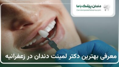 بهترین دکتر لمینت دندان در زعفرانیه