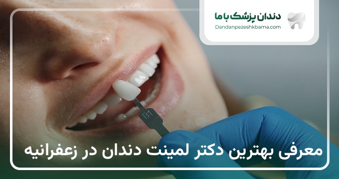 بهترین دکتر لمینت دندان در زعفرانیه