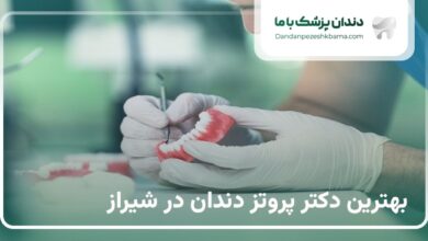 بهترین دکتر پروتز دندان در شیراز
