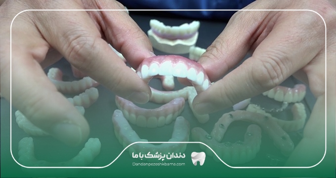 هزینه خدمات بهترین دکتر پروتز دندان در زعفرانیه
