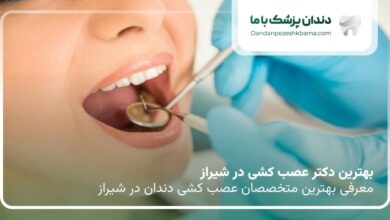 بهترین دکتر عصب کشی در شیراز