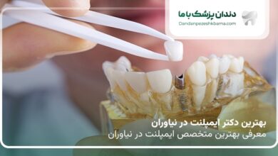 بهترین دکتر ایمپلنت در نیاوران