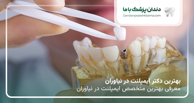 بهترین دکتر ایمپلنت در نیاوران