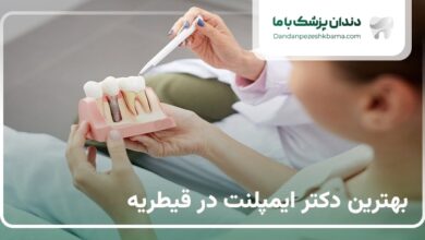 بهترین دکتر ایمپلنت در قیطریه