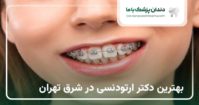 بهترین دکتر ارتودنسی در شرق تهران