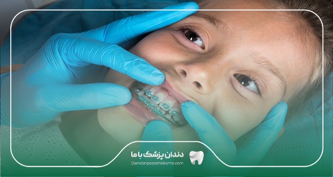 هزینه خدمات بهترین دکتر ارتودنسی در نیاوران