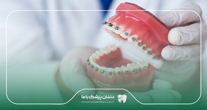 مراقبت‌های بعد از ارتودنسی