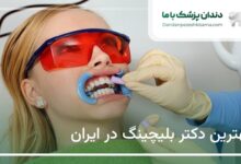 بهترین دکتر بلیچینگ در ایران
