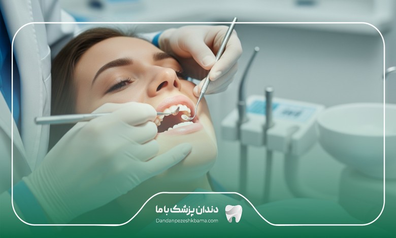 تعرفه خدمات بهترین دکتر کامپوزیت در تجریش