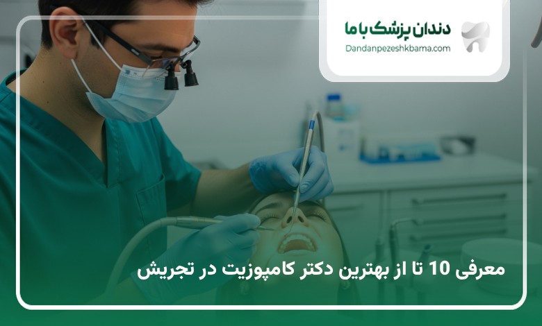 بهترین دکتر کامپوزیت در تجریش