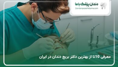 بهترین دکتر بریج دندان در ایران