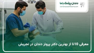 بهترین دکتر پروتز دندان در تجریش