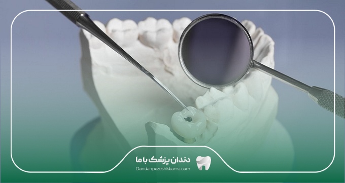 هزینه ترمیم دندان در شیراز