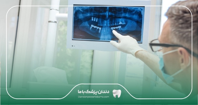 هزینه خدمات جراحی فک و صورت در زعفرانیه