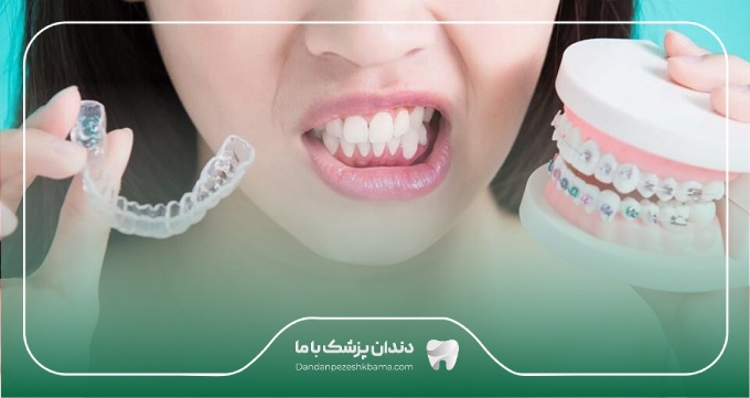 مراقبت های بعد از ارتودنسی