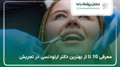 بهترین دکتر ارتودنسی در تجریش