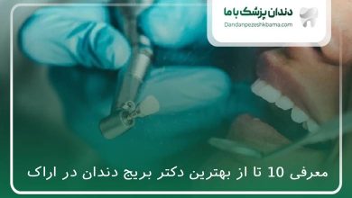 بهترین دکتر بریج دندان در اراک