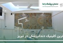 بهترین کلینیک دندانپزشکی در تبریز