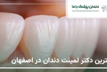 بهترین دکتر لمینت دندان در اصفهان